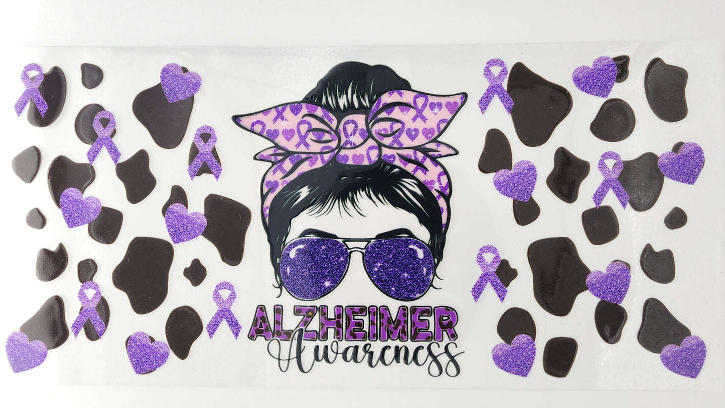 Alzheimer 02