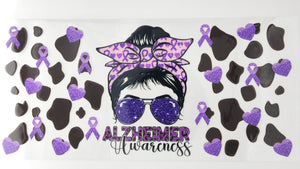 Alzheimer 02
