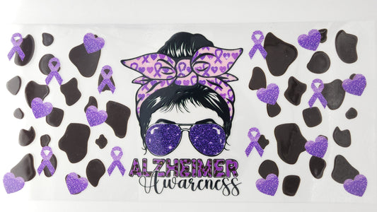 Alzheimer 02
